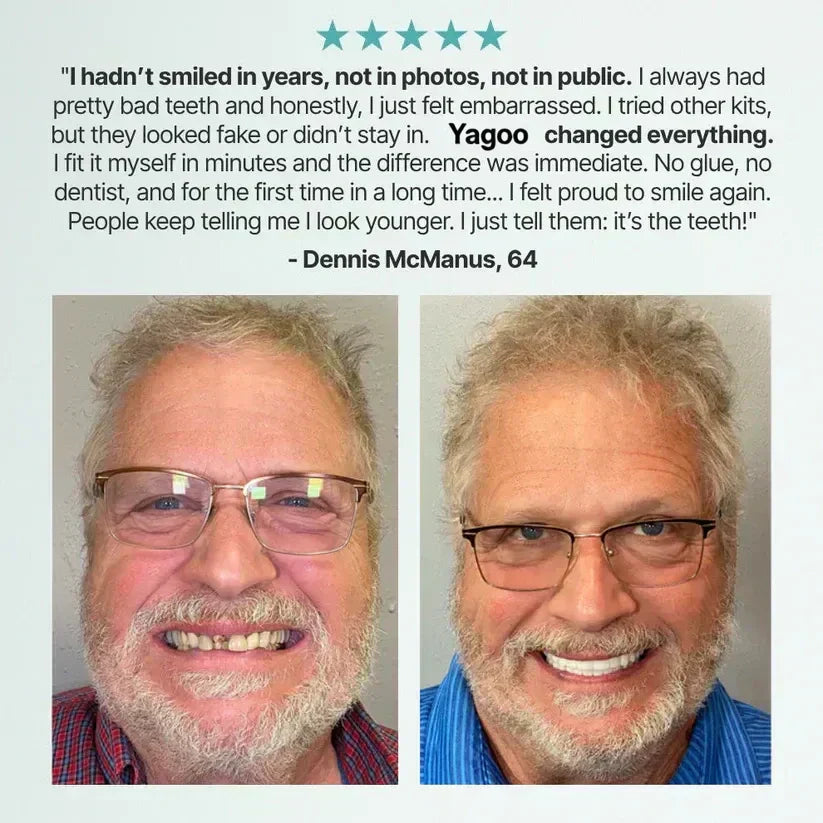 🔥Ends Today: 79% OFF!🏆2026 Bestselling Product🦷 Fit for a Fresh Smile, Say Goodbye to Wearing Discomfort!🌎