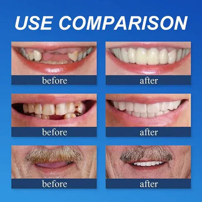 🔥Ends Today: 79% OFF!🏆2026 Bestselling Product🦷 Fit for a Fresh Smile, Say Goodbye to Wearing Discomfort!🌎