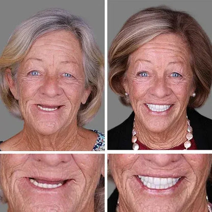🔥Ends Today: 79% OFF!🏆2026 Bestselling Product🦷 Fit for a Fresh Smile, Say Goodbye to Wearing Discomfort!🌎